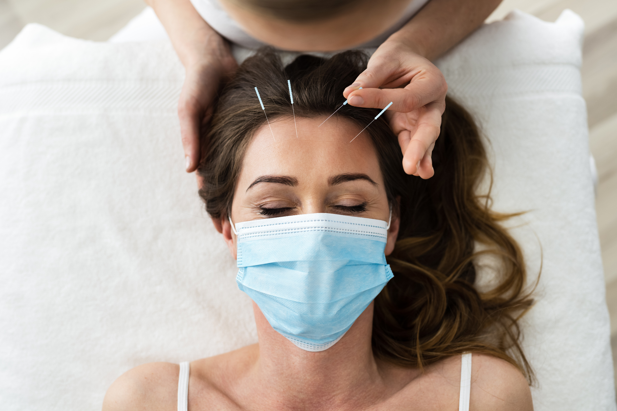 Acupuncture Treatment done on woman's forehead
